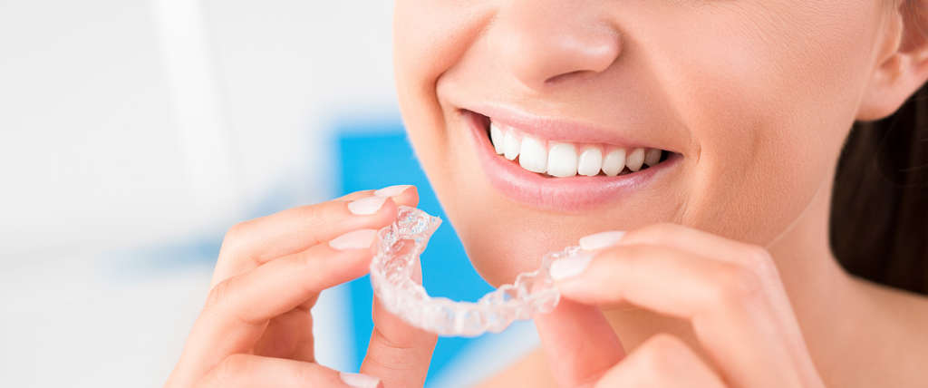 apparecchio dentista chivasso