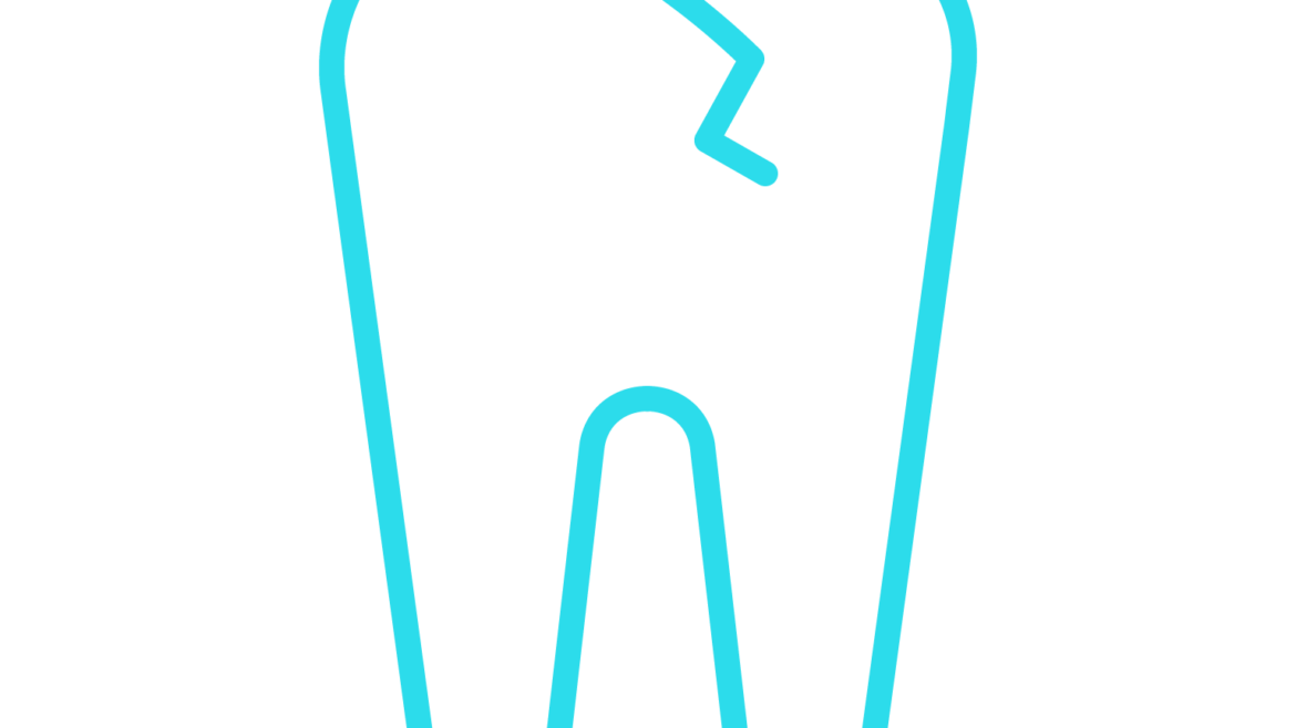Conservativa ed endodonzia
